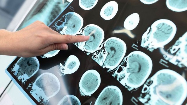 La creación colaborativa audiovisual al servicio de las terapias para enfermedades neurodegenerativas