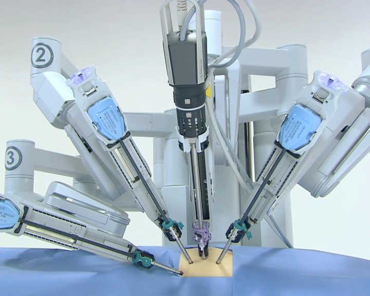 La cirugía robótica reduce la estancia hospitalaria en una media de 3 días