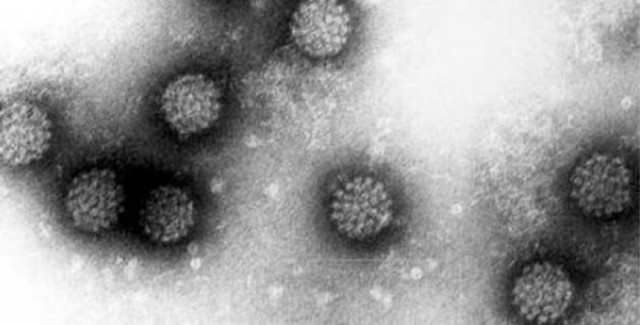 Cada año se diagnostican alrededor de 50.000 casos del tumor del virus del papiloma