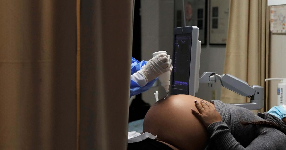  Sanidad y las CCAA analizan si autorizar la vacuna de Janssen a menores de 60 años y vacunar a embarazadas