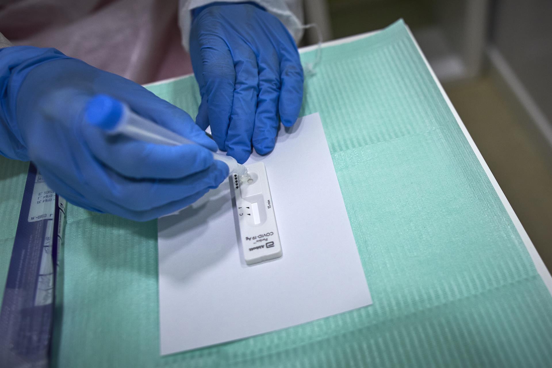 Sanidad inicia los trámites para permitir la venta sin receta de test de autodiagnóstico en farmacias