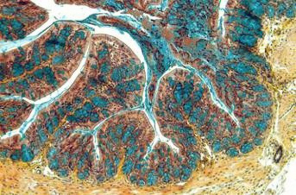 El CSIC describe una nueva terapia para tratar la enfermedad inflamatoria intestinal
