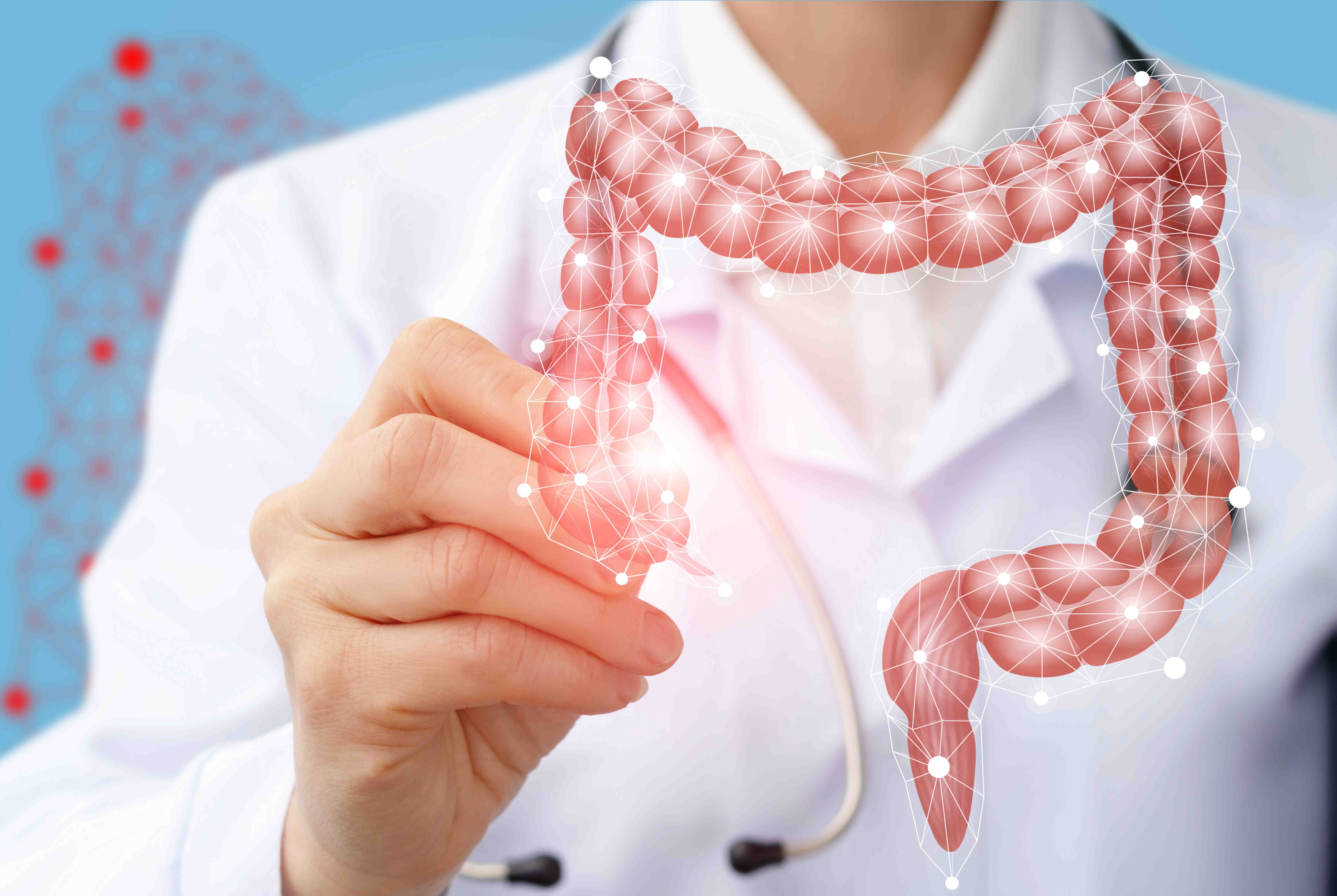 ¿En qué consiste la cirugía de cáncer de colón? 