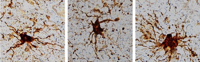 Descubren 'genes zombies' que cobran vida en el cerebro después de la muerte
