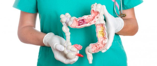 El cáncer colorrectal ya supone el 15% de todos los tumores
