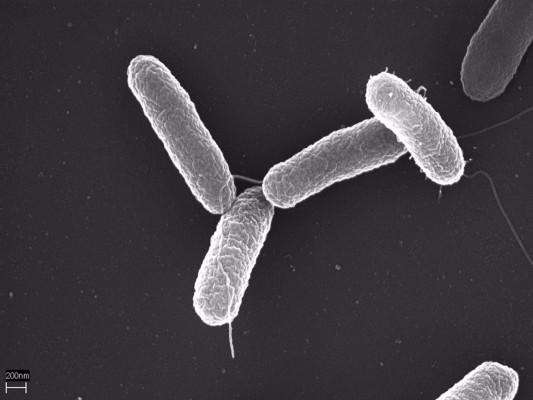  Investigadores explican el sistema que permite a la bacteria Salmonella sobrevivir en el cuerpo humano
