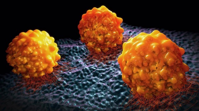Logran explicar cómo el cáncer de páncreas consigue eludir la inmunoterapia
