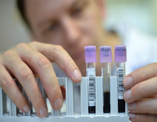 Entre el 17% y el 75% de los pacientes con lupus padecen depresión o alteraciones del estado de ánimo

