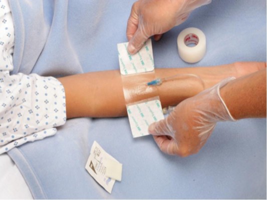 Las infecciones por catéter cuestan casi 2 millones de euros al año por cada hospital
