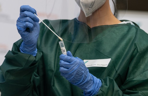 PCR y test rápido: funcionamiento y diferencias entre ambas pruebas