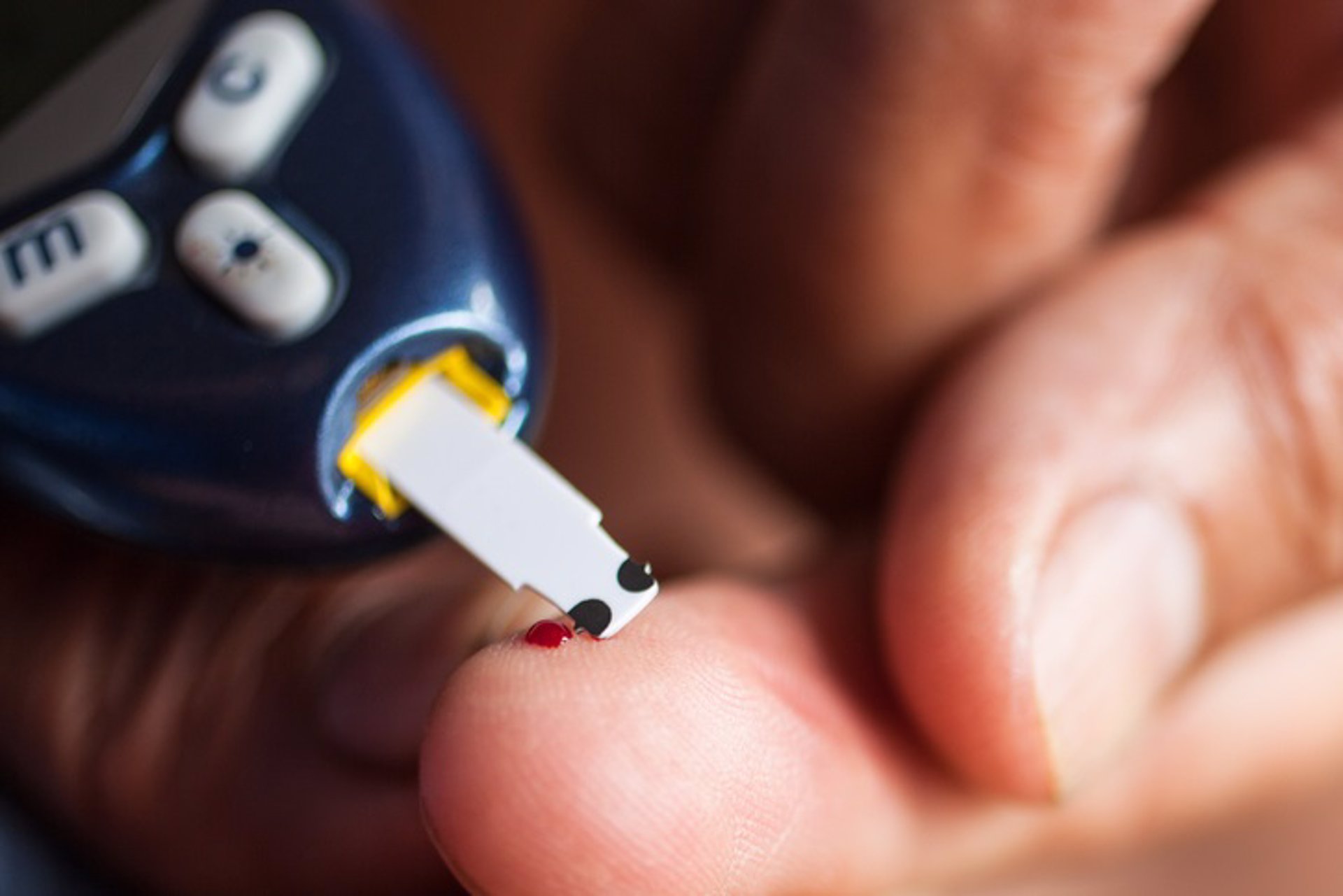 La mayoría de pacientes con diabetes tipo 2 tienen alto riesgo de ataque cardíaco o trombosis cerebral 