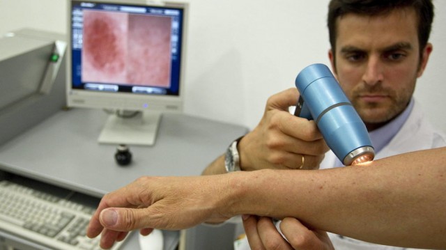 Los médicos detectan anualmente entre 5 y 8 casos nuevos de melanoma por cada 100.000 habitantes en la Comunitat