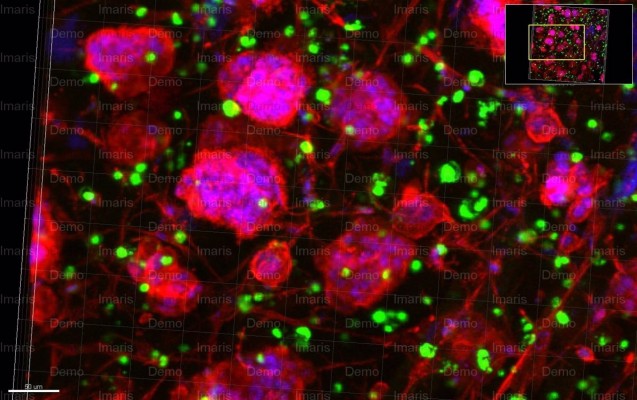Un estudio apunta que un suplemento nutricional común podría mejorar la inmunoterapia contra el cáncer