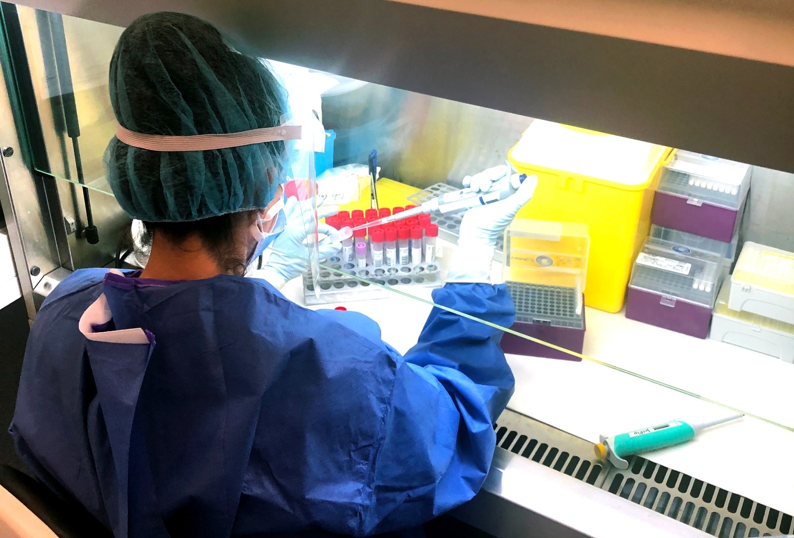 IMED Hospitales incorpora la prueba de antígenos que permite diagnosticar la covid-19 en 15 minutos
