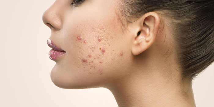 Casi el 40% de consultas de dermatología están asociadas a factores emocionales