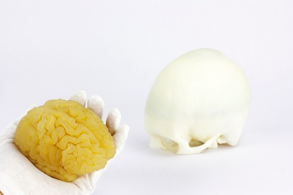  
AIJU presenta un servicio de impresión 3D para replicar órganos y patologías concretas con precisión ultra realista pionero en Europa
