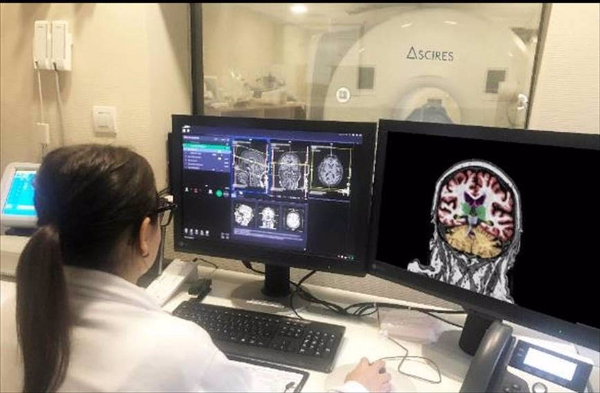 Investigadores españoles descubren una nueva alteración en el cerebro de las personas con Alzheimer
