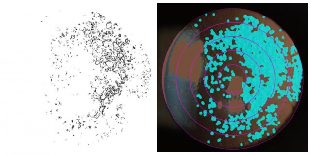 La UA patenta un software que cuantifica la opacidad en la lente ocular