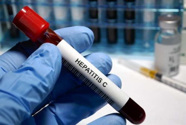 España podría eliminar la hepatitis C seis o siete años antes del objetivo fijado por la OMS