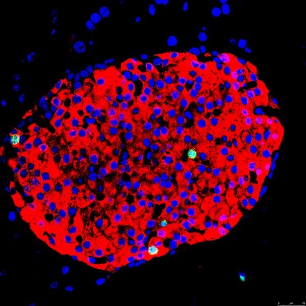 Una instantánea del estudio que se lleva a cabo. - UMH  - 