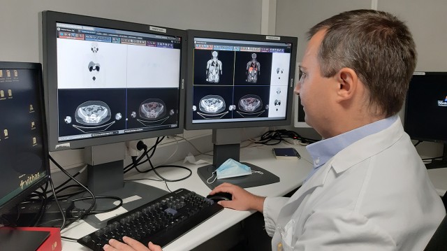 Vithas Valencia 9 de Octubre realiza el primer PET-PSMA de la Comunitat para detectar recidivas del cáncer de próstata