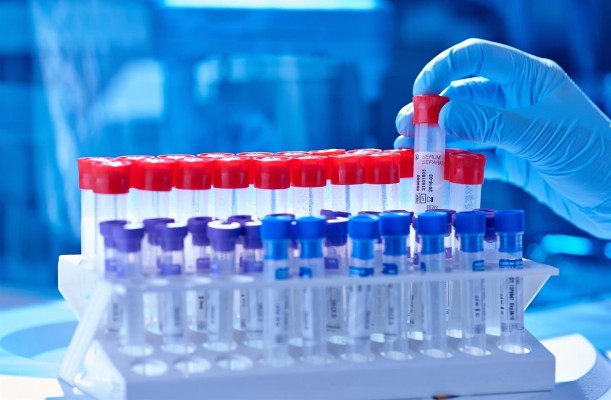 El calor hace que se disparen las consultas de urología por cálculos renales