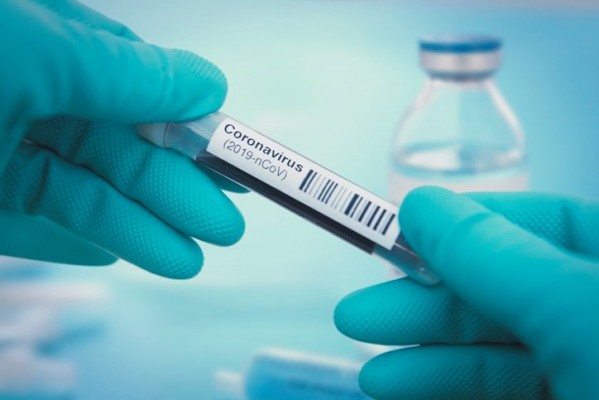 Sanidad informa de siete muertes y 134 contagios por covid-19 en las últimas 24 horas