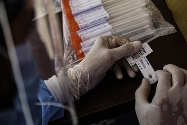 Sanidad informa de 25 muertes en España en una semana pero no varía los datos de fallecidos totales 