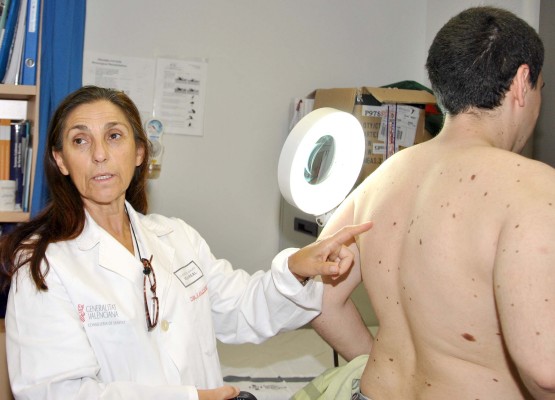Los dermatólogos recuerdan el riesgo de la exposición solar después del confinamiento