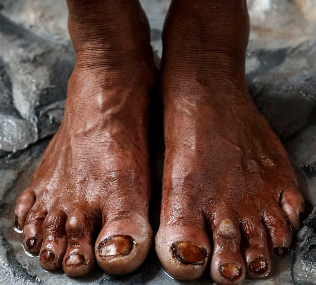 Ocho artistas y una denuncia: ¡Solución a las condiciones inhumanas en las fábricas de calzado!