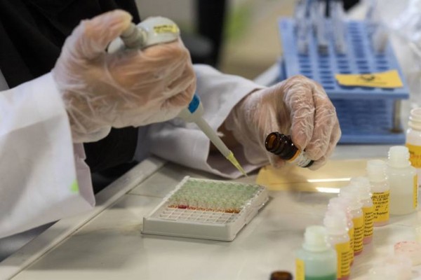 Las empresas biotecnológicas de Alicante piden que se clarifique el método idóneo para los test