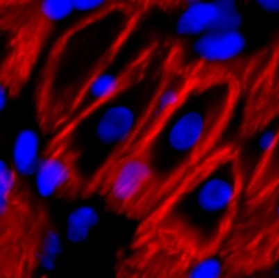 Descubren una proteína en ratones que podría ayudar a las células del corazón a autoregenerarse
