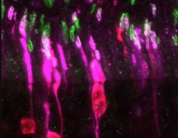 Hallan una proteína responsable de la muerte celular que provoca un tipo de ceguera
