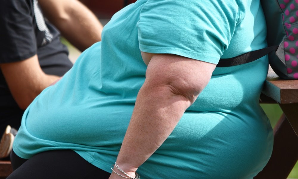 La obesidad es una de las tres principales causas de muerte en la mayoría de países del mundo