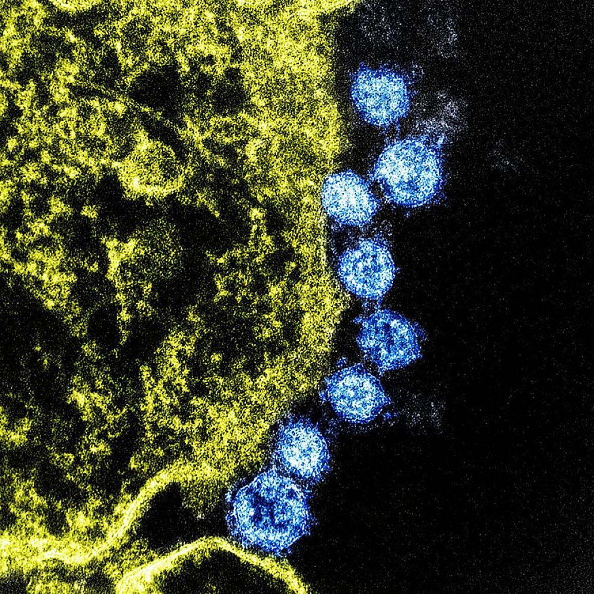 Científicos estadounidenses creen que una vacuna preliminar contra el nuevo coronavirus podría estar lista en 3 meses

