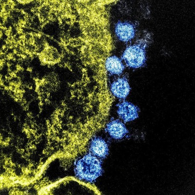 Científicos estadounidenses creen que una vacuna preliminar contra el nuevo coronavirus podría estar lista en 3 meses

