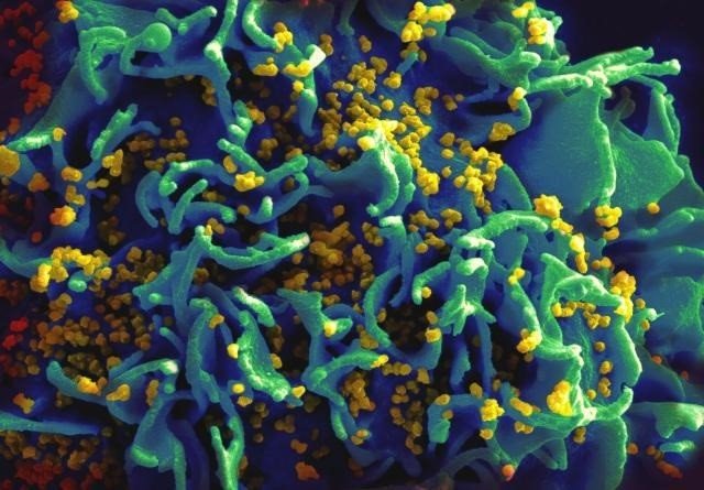 La OMS avisa de que más del 50 % de personas con VIH se diagnostican tarde y 1 de cada 5 no sabe su estado
