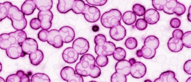 Identifican nuevos mecanismos por los que las células pueden desactivar algunos genes