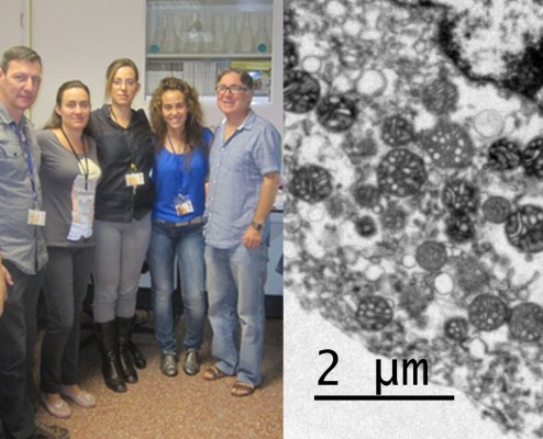 Investigadores de la UMH estudian un tratamiento de la esclerosis que podría eliminar células tumorales del cerebro

