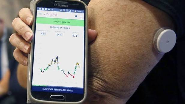Un microchip dentro de la boca permitirá a los diabéticos medir la glucosa