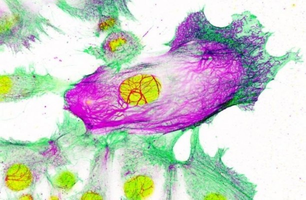 Investigadores del CNIO identifican una posible vía para la prevención de cáncer de mama
