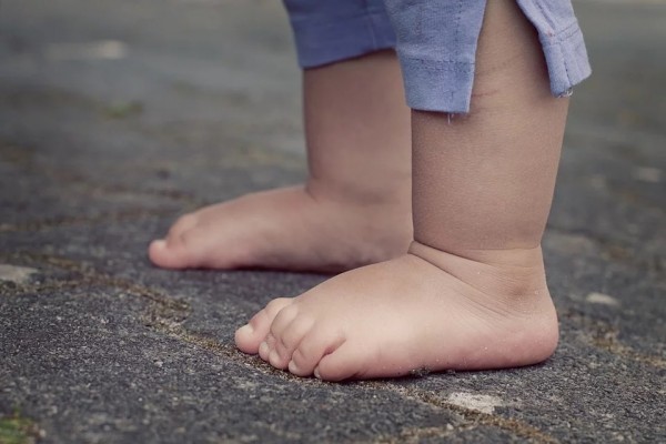 El sobrepeso es causa de patologías en los pies de los niños, según el Colegio de Podólogos