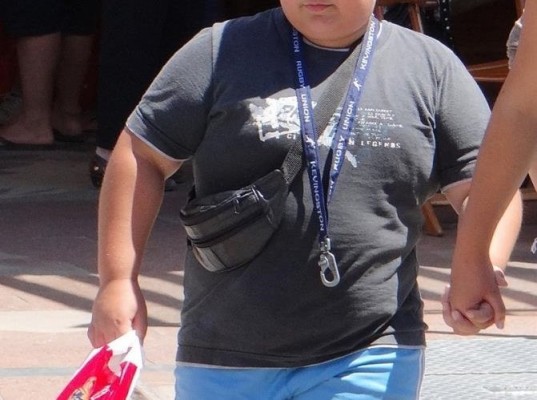 El sobrepeso es causa de patologías en los pies de los niños, según ICOPCV