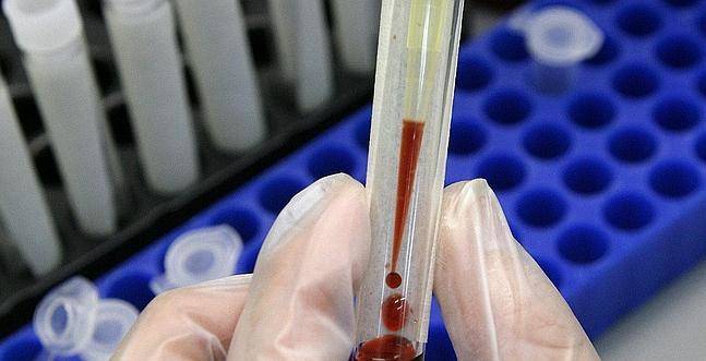 Una compañía plantea lanzar un test de sangre que podría detectar el cáncer de colon 15 años antes
