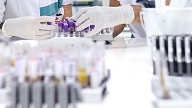 Un 5% de los varones que se han realizado la prueba gratuita del PSA presentan problemas prostáticos 