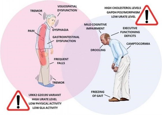 Investigadores explican por qué el Parkinson afecta de forma diferente a mujeres y hombres
