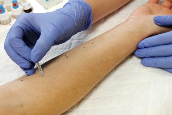 Los dermatólogos resaltan que notificar las reacciones cutáneas alérgicas es clave para prevenir problemas de piel