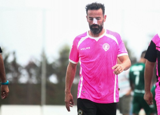 Empate a nada y fractura de nariz de Peña