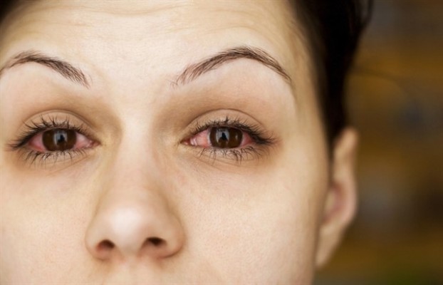 La contaminación, un factor de riesgo para desarrollar conjuntivitis o intolerancia a las lentillas