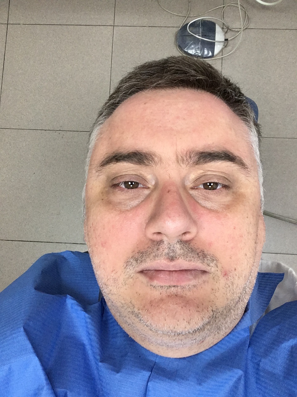 El selfiematón de Toni Aura